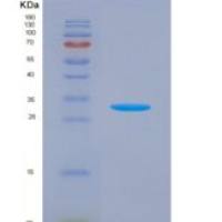 人含NLR家族Pyrin域蛋白3(NLRP3)重组蛋白