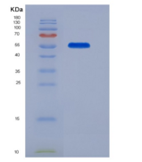 人核糖核酸酶T2(RNASET2)重组蛋白