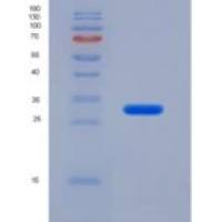 人层粘连蛋白γ1(LAMC1)重组蛋白