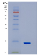 人腺苷酸环化酶关联蛋白1(CAP1)重组蛋白