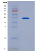 人Toll样受体4(TLR4)重组蛋白