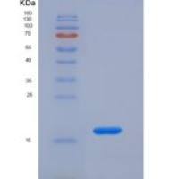 人单核细胞趋化蛋白1/cc L2重组蛋白