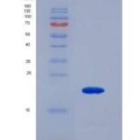 人维生素D受体(VDR)重组蛋白