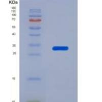 人纤连蛋白(FN)重组蛋白