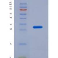 大鼠白介素17受体A(IL17RA)重组蛋白