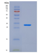 小鼠GATA结合蛋白4(GATA4)重组蛋白
