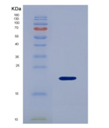 小鼠趋化因子C-X-C-基元受体3(CXCR3)重组蛋白