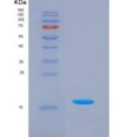 人左右决定因子2(LEFTY2)重组蛋白