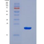 人肽聚糖识别蛋白1(PGLYRP1)重组蛋白