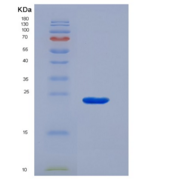 小鼠α1-酸性糖蛋白(a1AGP)重组蛋白