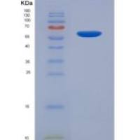 大鼠色素上皮衍生因子(PEDF)重组蛋白