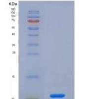 大鼠趋化因子 (C-X-C基序)配体1(CXCL1)重组蛋白