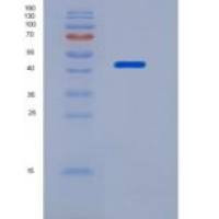 大鼠类固醇5α还原酶1(SRD5a1)重组蛋白