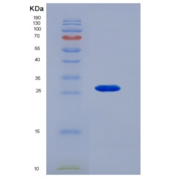 大鼠核因子κB受体激活因子(RANk)重组蛋白