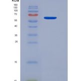 大鼠内皮细胞TEK酪氨酸激酶(Tie2)重组蛋白