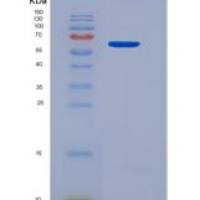 大鼠内皮细胞TEK酪氨酸激酶(Tie2)重组蛋白