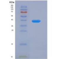 人血管内皮生长因子受体1(VGFR1)重组蛋白