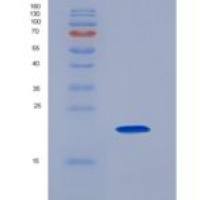 大鼠肿瘤坏死因子受体超家族成员5(CD40)重组蛋白