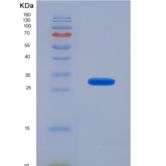 人核糖核酸酶L(RNASEL)重组蛋白