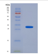 人核糖核酸酶L(RNASEL)重组蛋白
