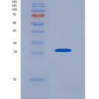 人纤维胶凝蛋白1(FCN1)重组蛋白