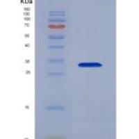 人巢蛋白(NID)重组蛋白
