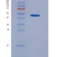 大鼠心肌钙黏蛋白(CDHH)重组蛋白