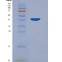 大鼠粒细胞巨噬细胞集落刺激因子2重组蛋白