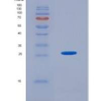 人干燥综合征抗原A1(SSA1)重组蛋白