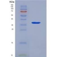 小鼠膜联蛋白A5(ANXA5)重组蛋白