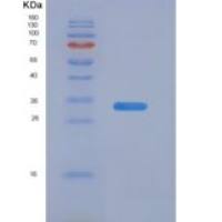 人粘着斑激酶(FAK)重组蛋白