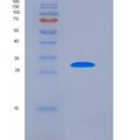 人Dicer酶1(DICER1)重组蛋白