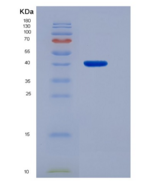 人免疫球蛋白A1(IgA1)重组蛋白