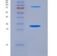 人Ⅻ型胶原(COL12)重组蛋白