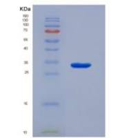 人含WW域E3泛素蛋白连接酶2(WWP2)重组蛋白