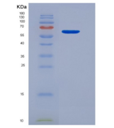 大鼠内皮细胞TEK酪氨酸激酶(Tie2)重组蛋白