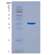 人雄激素受体(AR)重组蛋白
