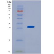 小鼠组织因子通道抑制因子2(TFPI2)重组蛋白