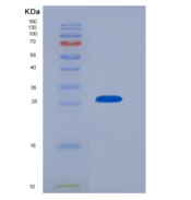 小鼠组织因子通道抑制因子2(TFPI2)重组蛋白