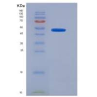 人法尼酯X受体(FXR)重组蛋白