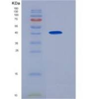 人唾液淀粉酶α1(AMY1A)重组蛋白