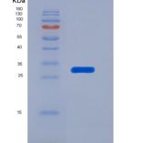 人硒蛋白P1(SEPP1)重组蛋白