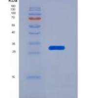 人硒蛋白P1(SEPP1)重组蛋白