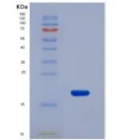 大鼠血栓调节蛋白(TM)重组蛋白