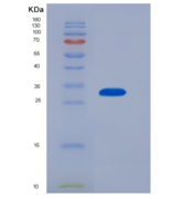 人白介素4诱导蛋白1(IL4I1)重组蛋白