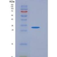 大鼠 白介素22受体(IL22R)重组蛋白