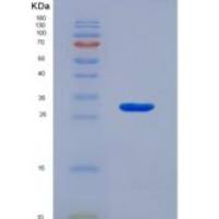 人含血管性血友病因子A域蛋白1(vWA1)重组蛋白