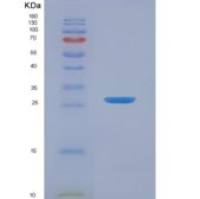 大鼠叶酸受体1(FOLR1)重组蛋白