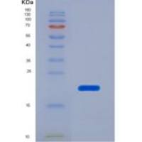人Toll样受体7(TLR7)重组蛋白