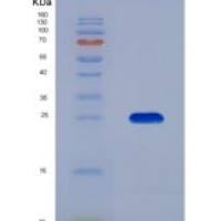 大鼠透明质酸结合蛋白1(C1QBP)重组蛋白